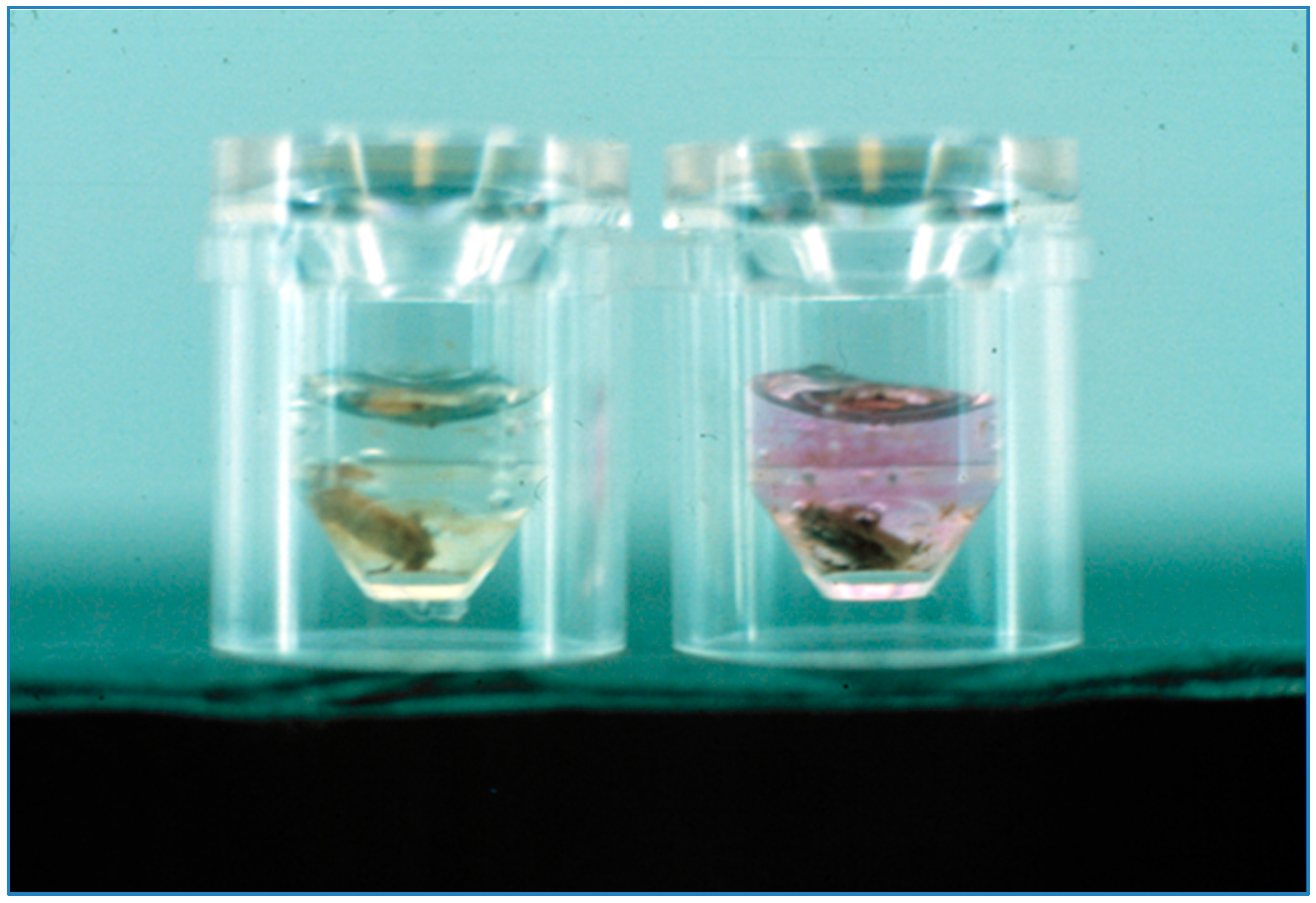 Neonatalscreening 02 00009 g001