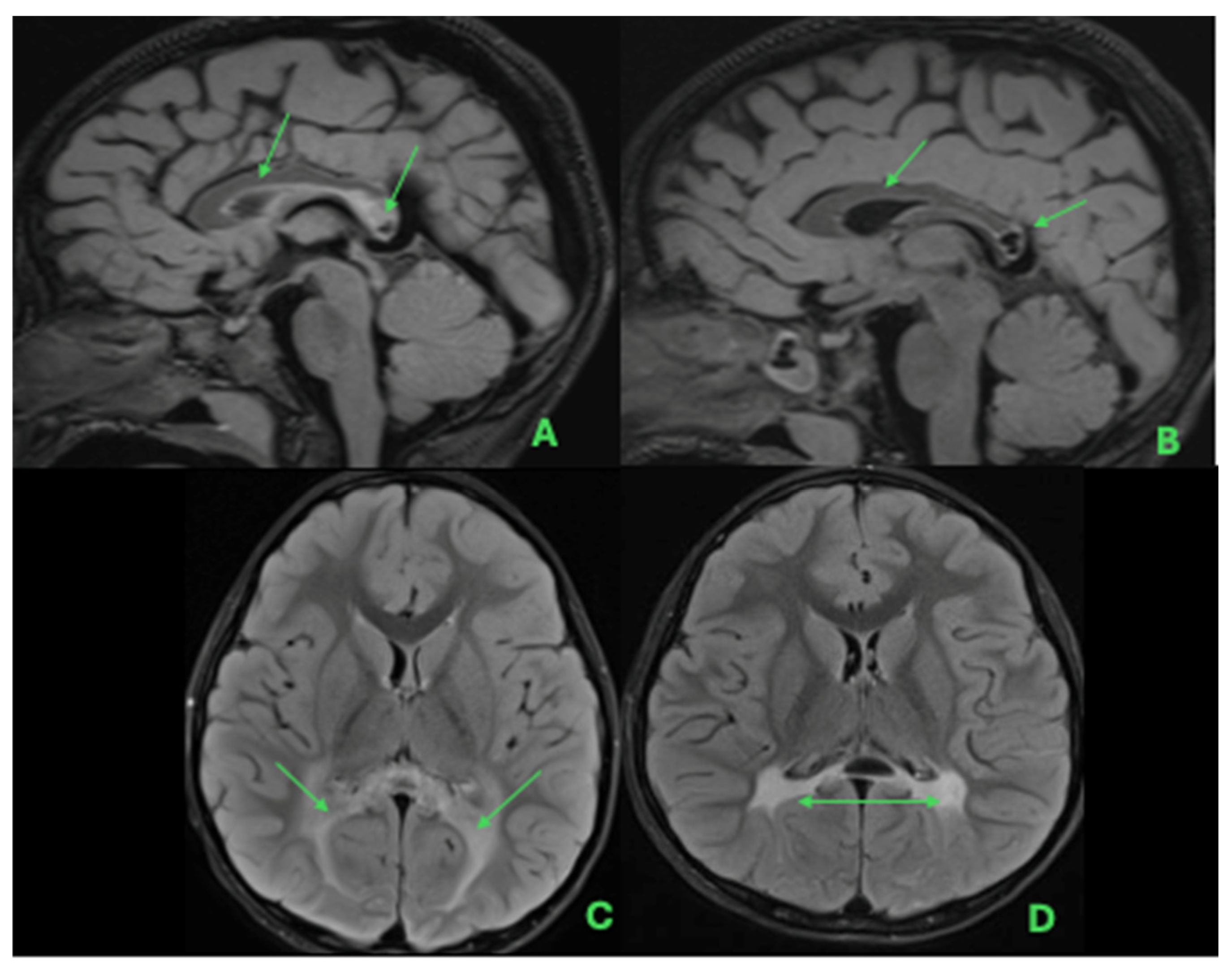 Ijns 12 00059 g004 Ijns 12 00059 g004