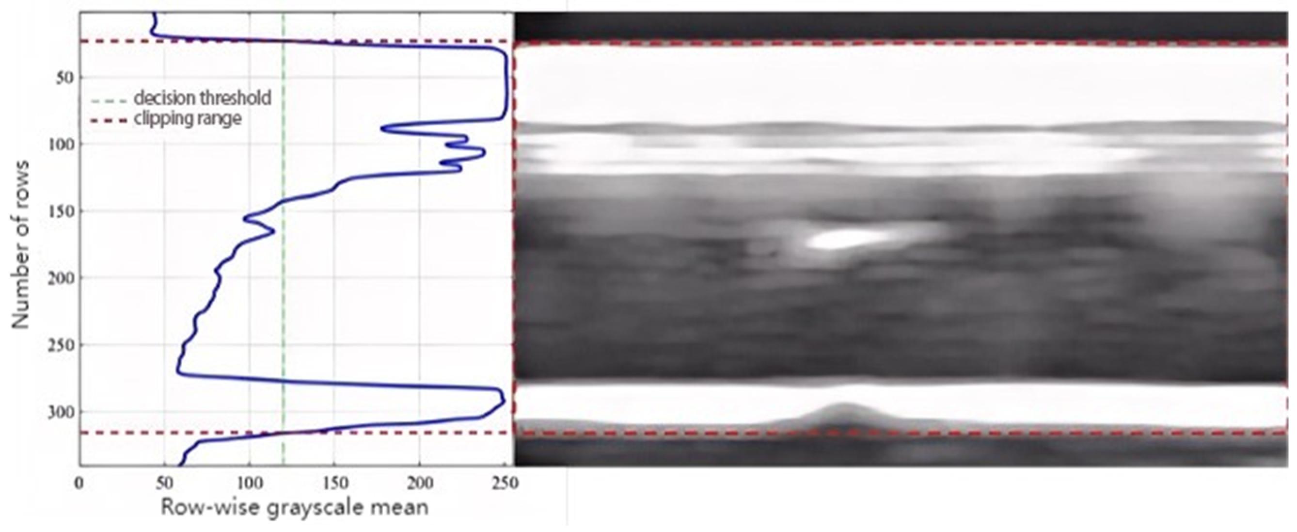 Acoustics 07 00035 g007