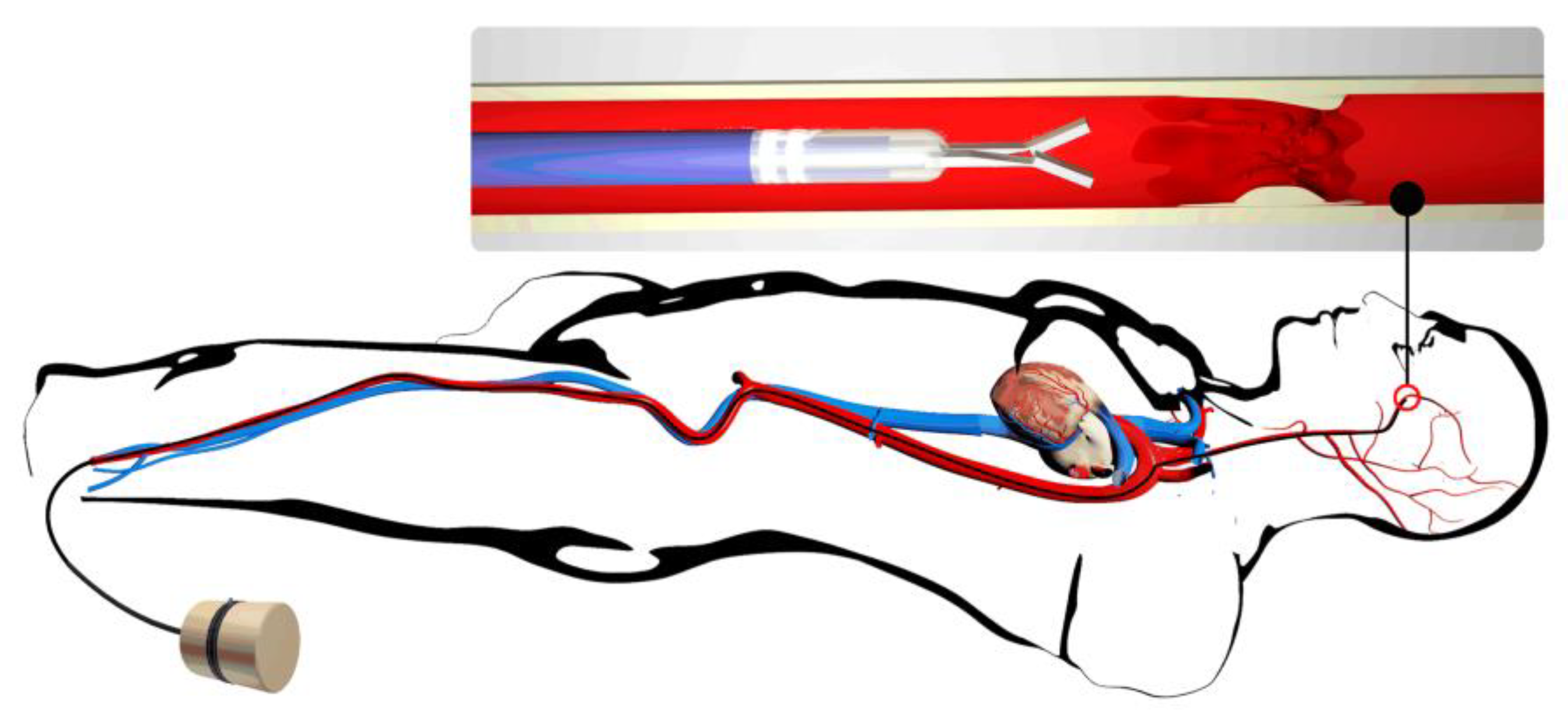 Actuators 12 00060 g001