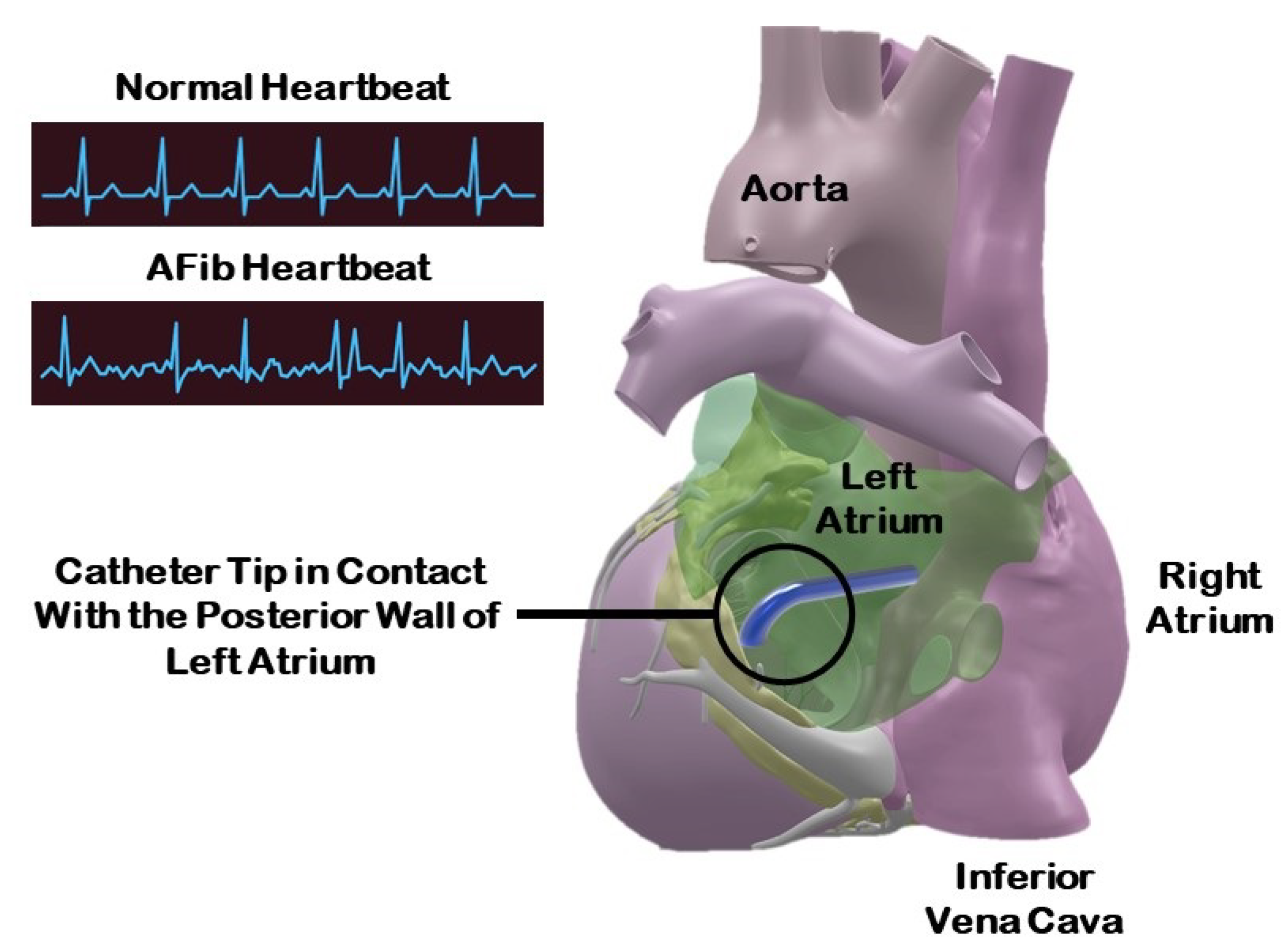 Actuators 13 00008 g001