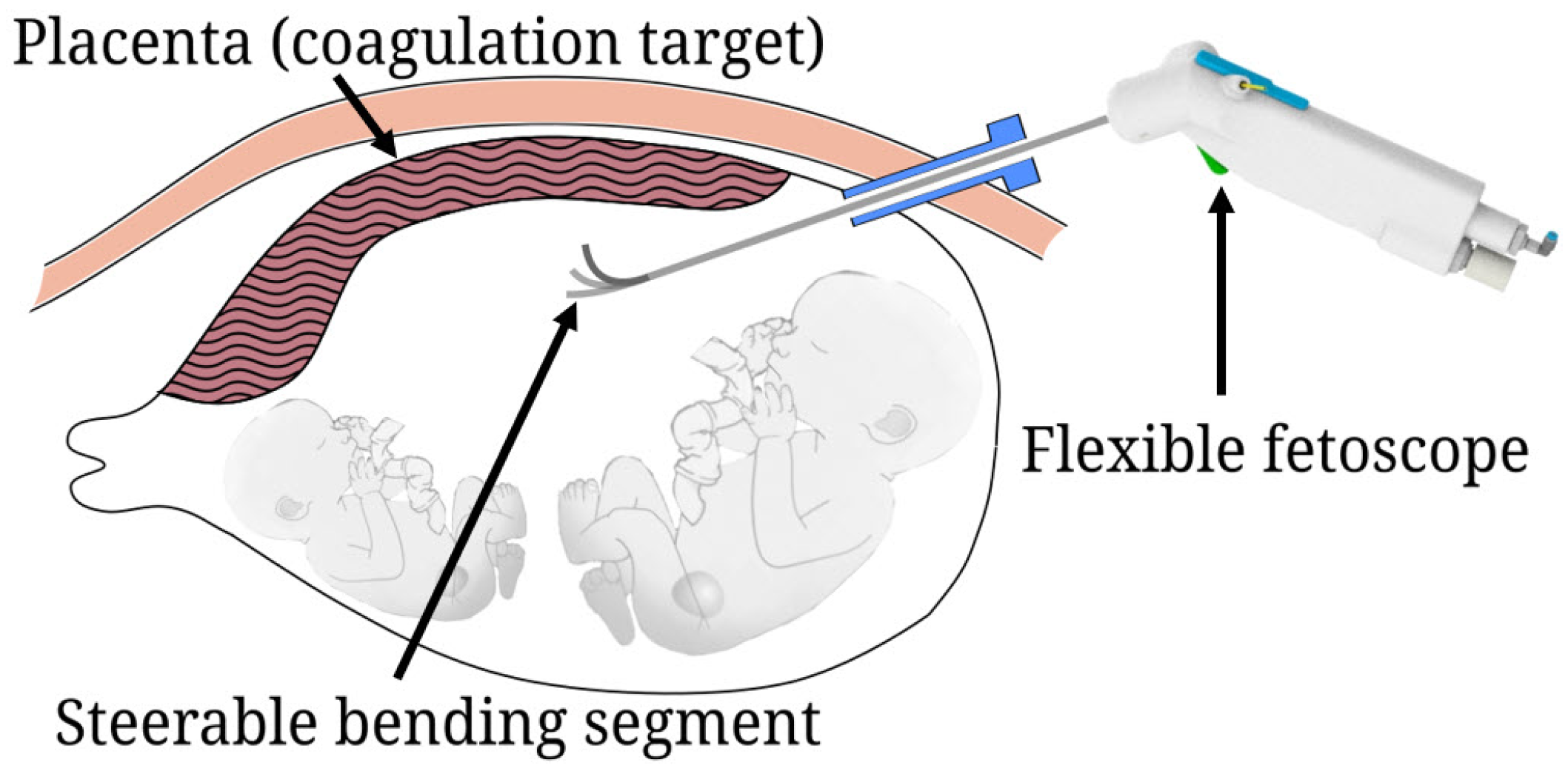 Actuators 13 00444 g001