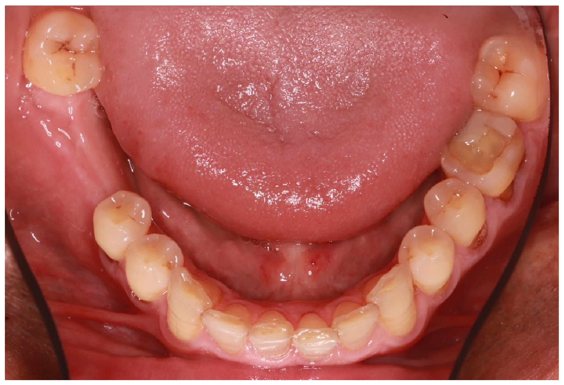 Adhesives 01 00006 g001