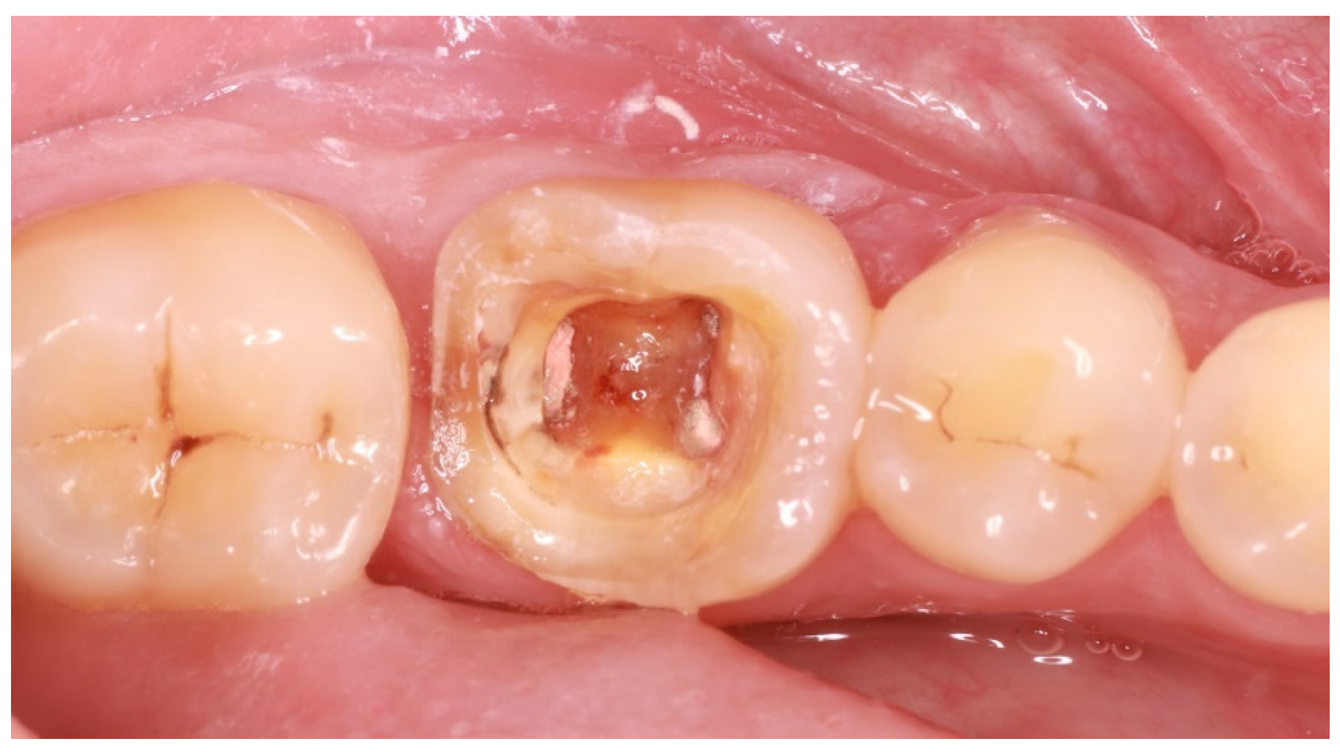 Adhesives 01 00006 g002