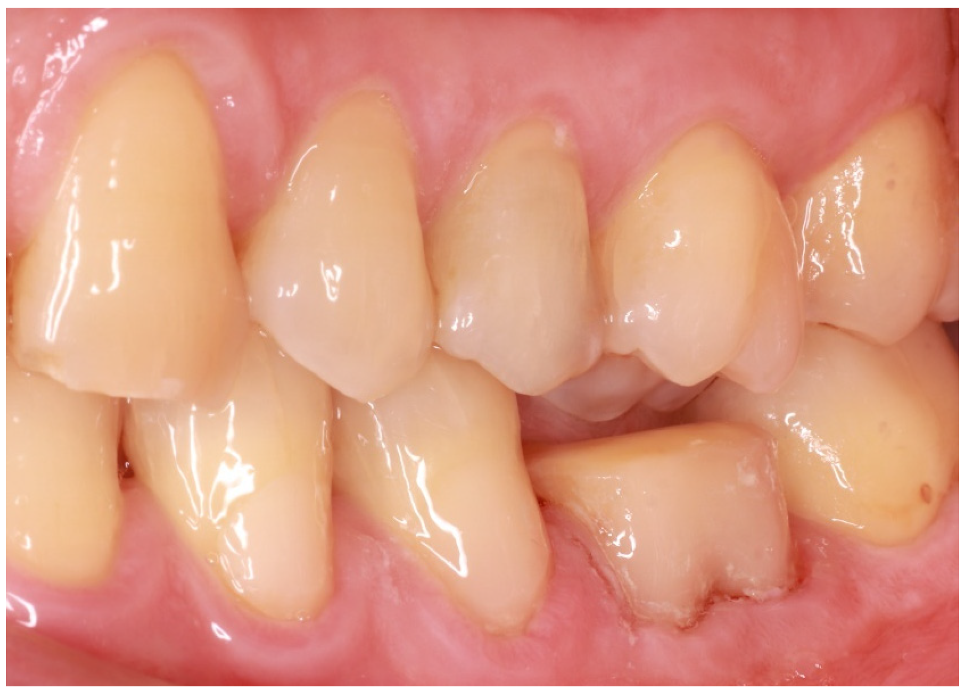 Adhesives 01 00006 g003