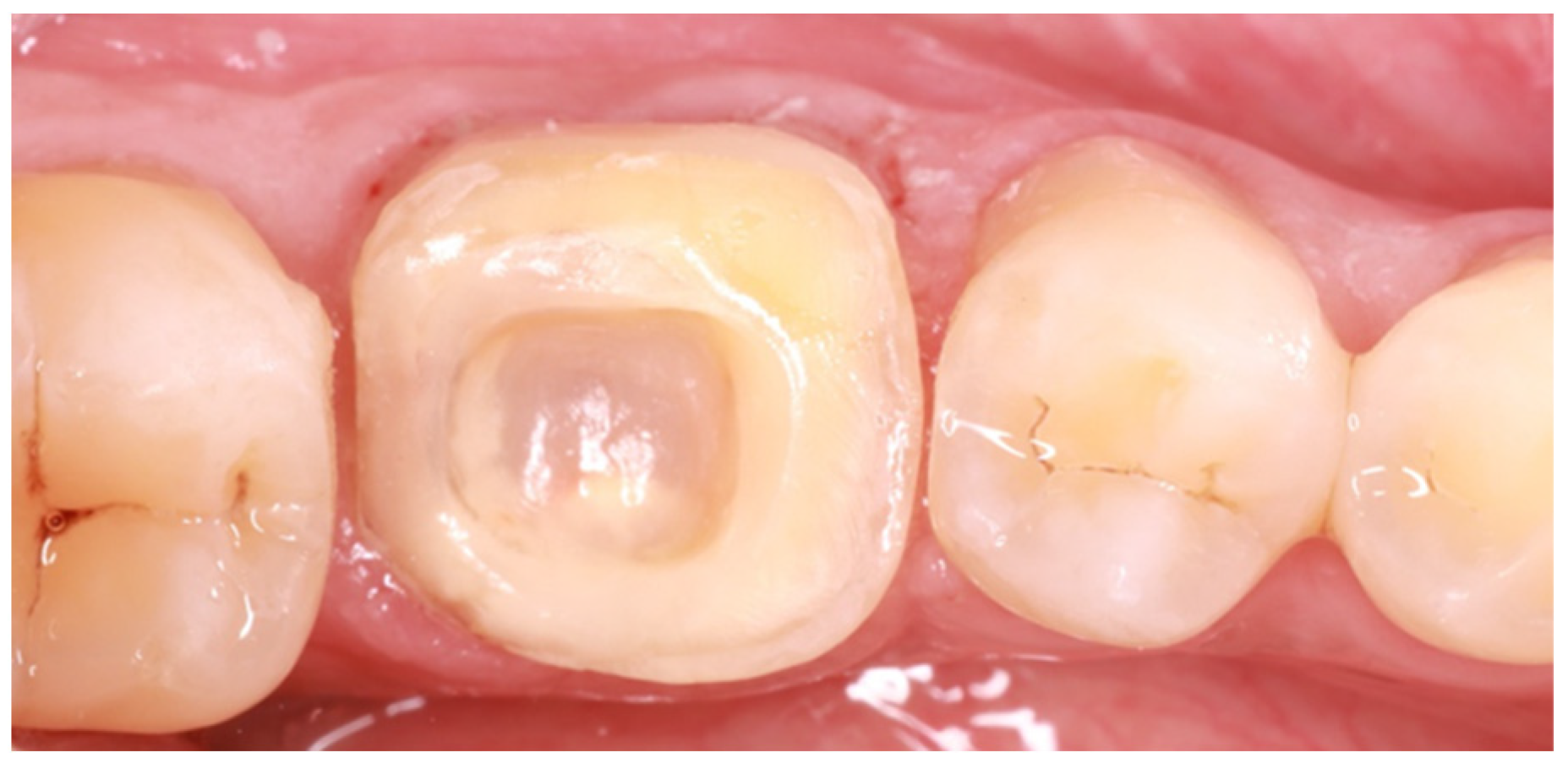 Adhesives 01 00006 g004