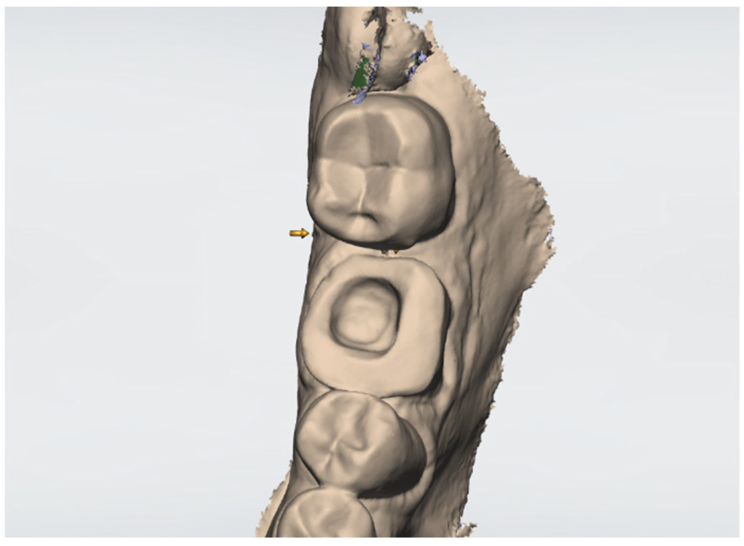 Adhesives 01 00006 g005
