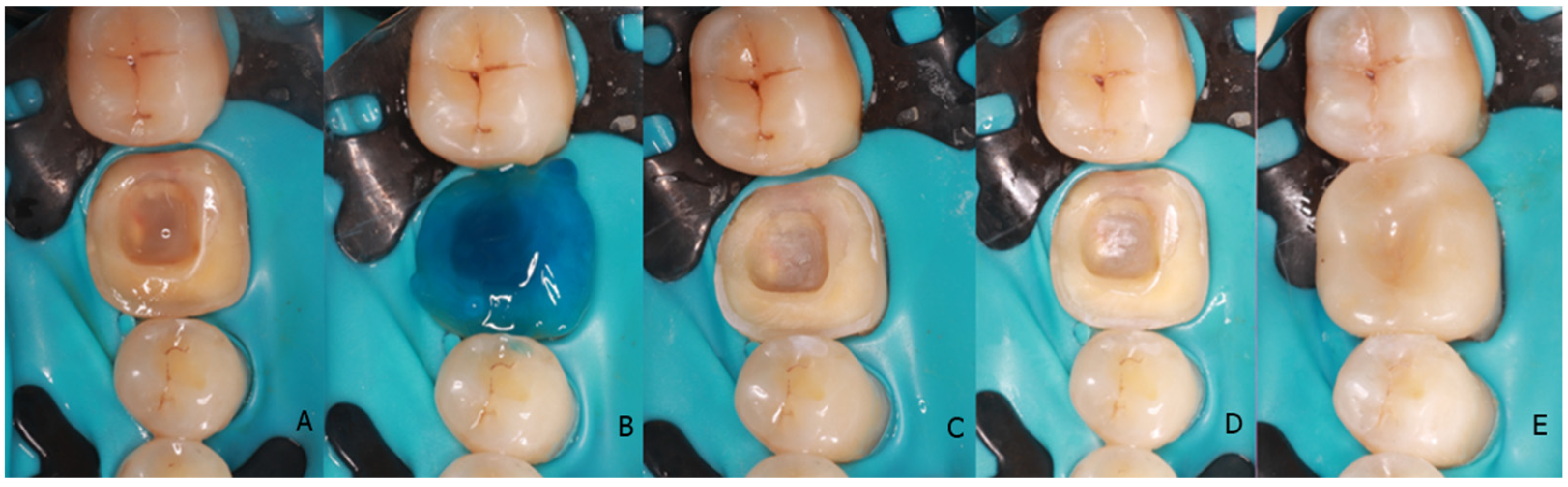 Adhesives 01 00006 g007