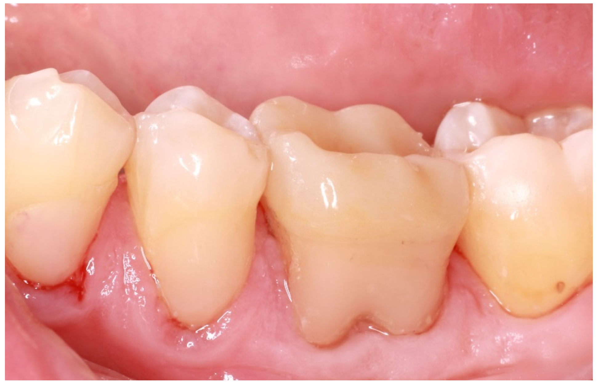 Adhesives 01 00006 g008