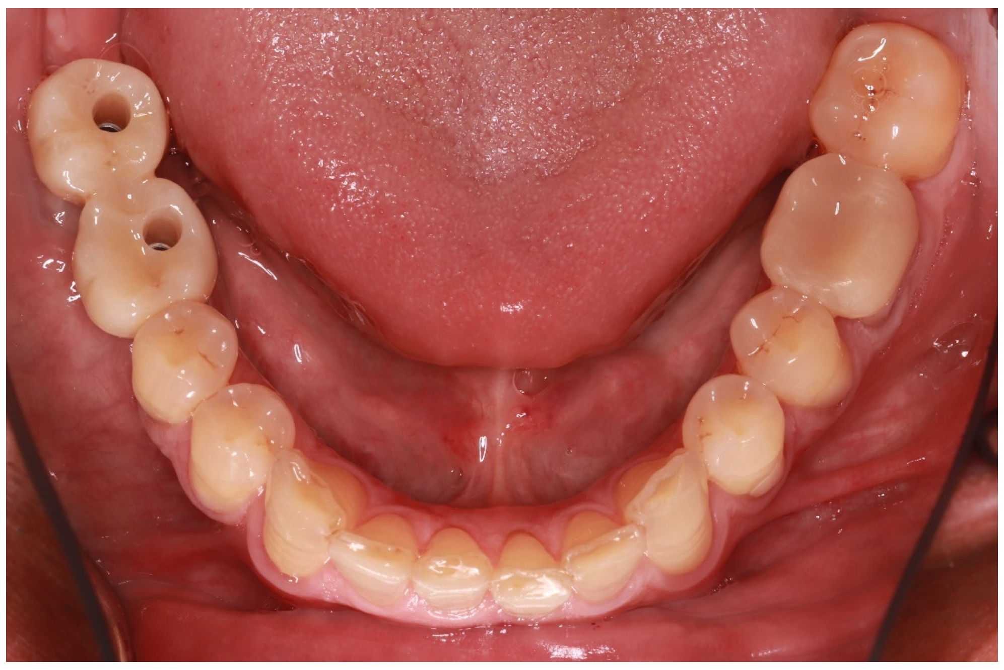 Adhesives 01 00006 g009