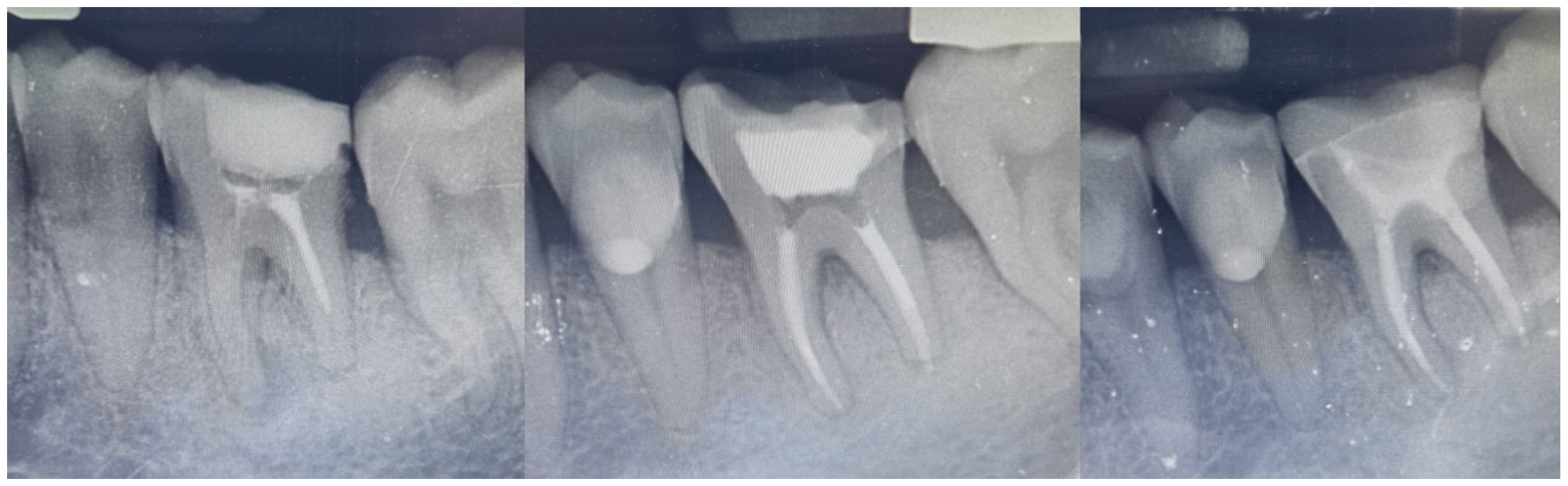 Adhesives 01 00006 g010