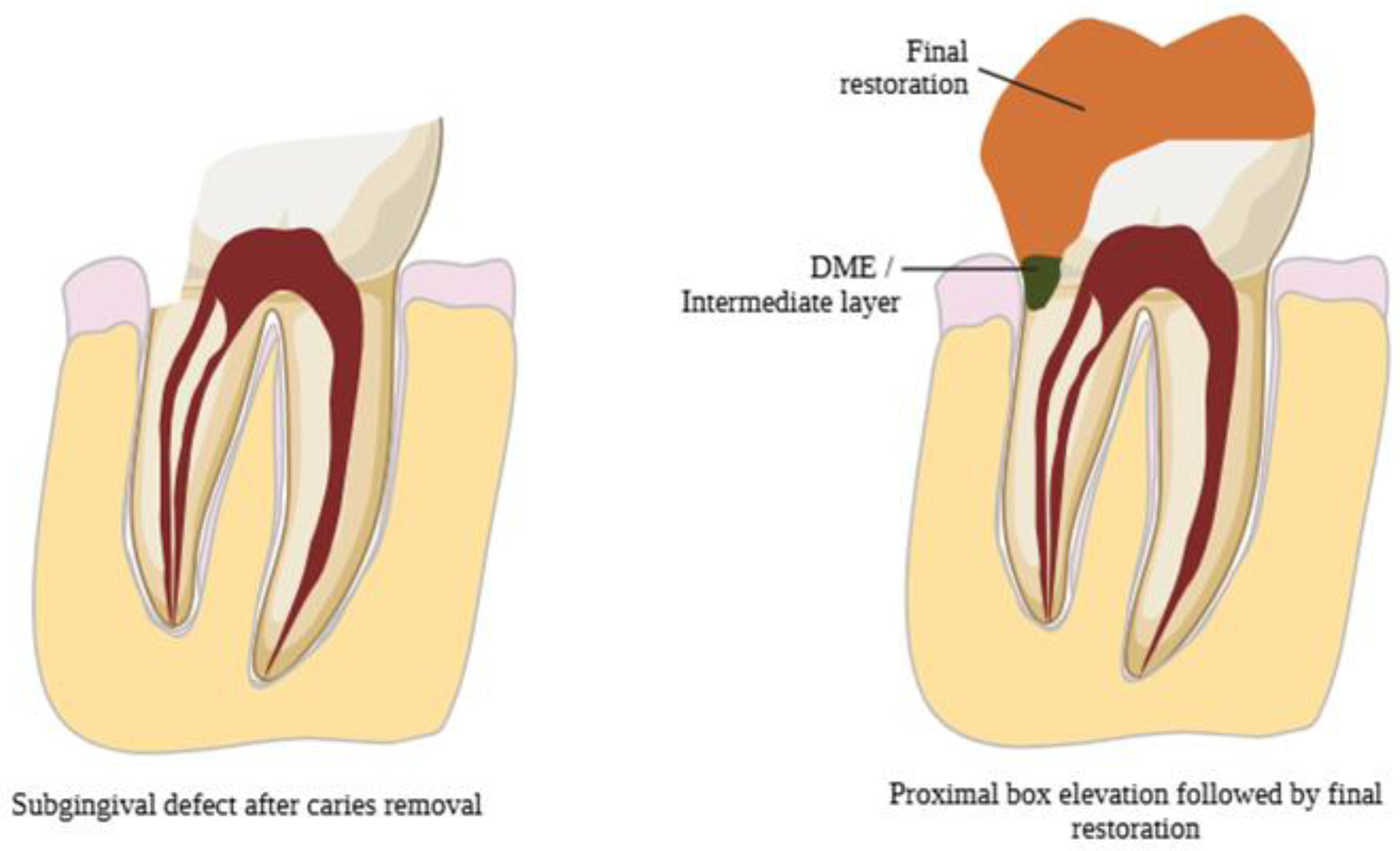 Adhesives 01 00010 g003