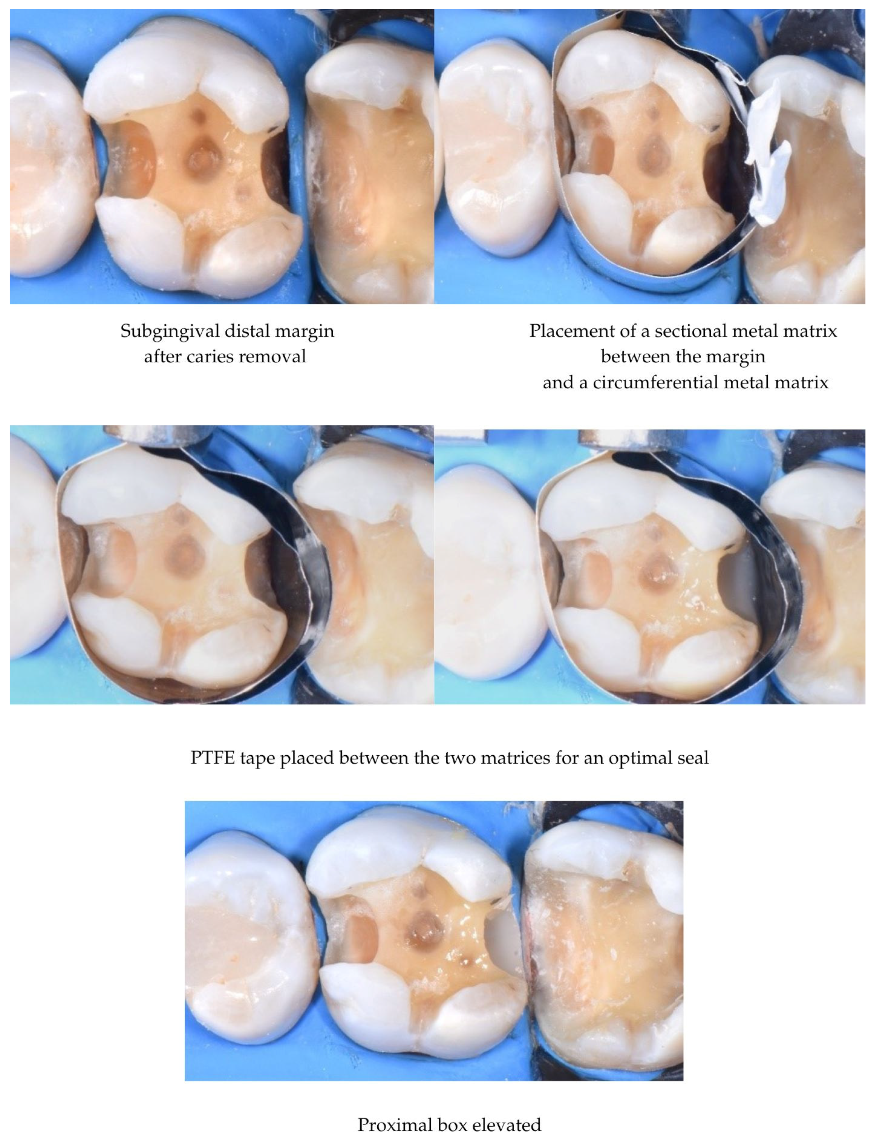Adhesives 01 00010 g005