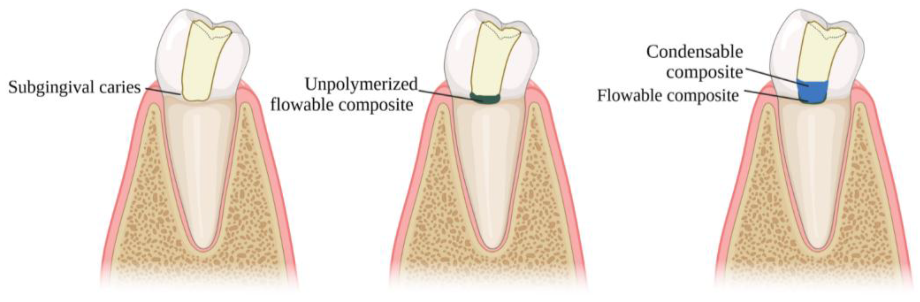 Adhesives 01 00010 g006