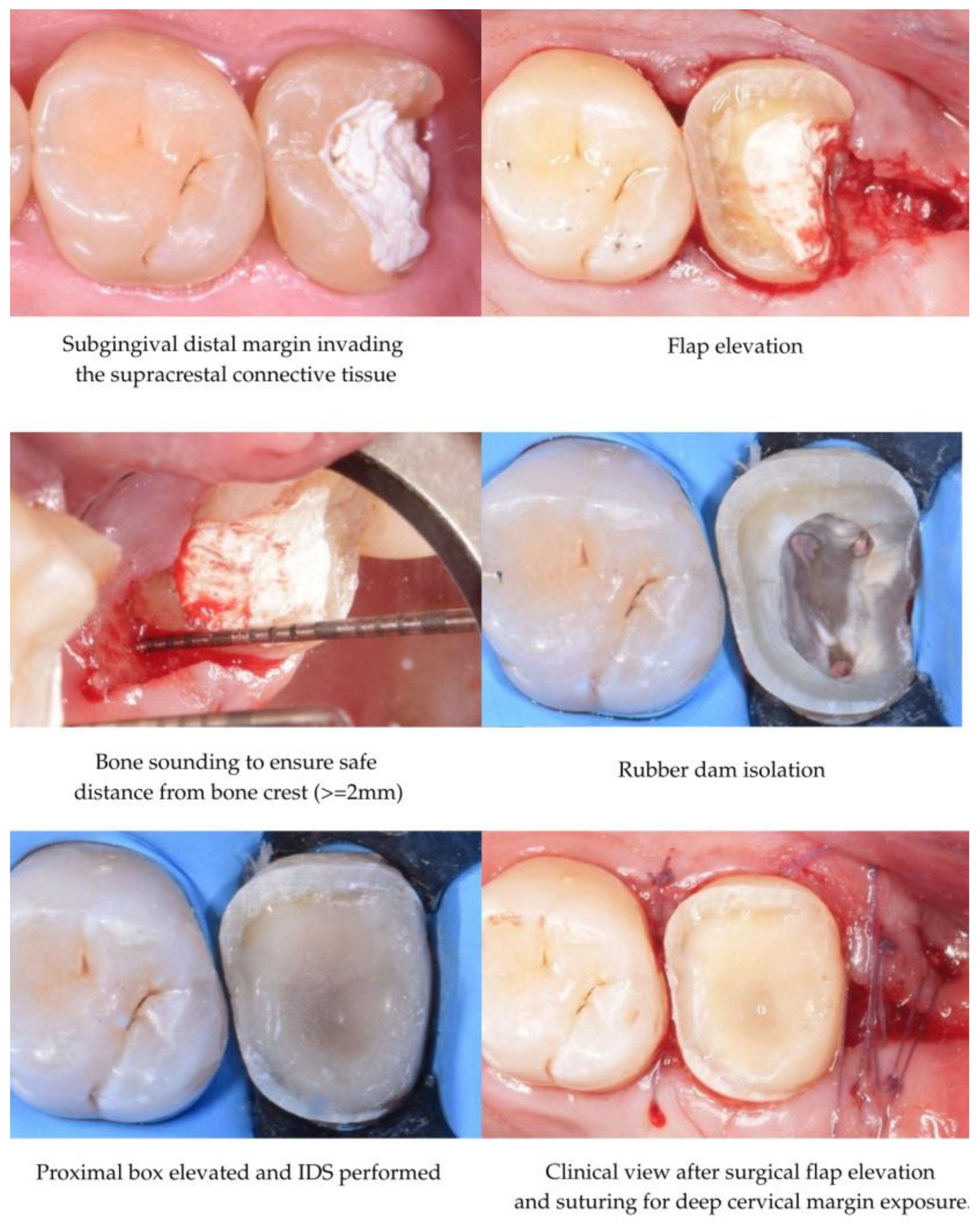 Adhesives 01 00010 g007