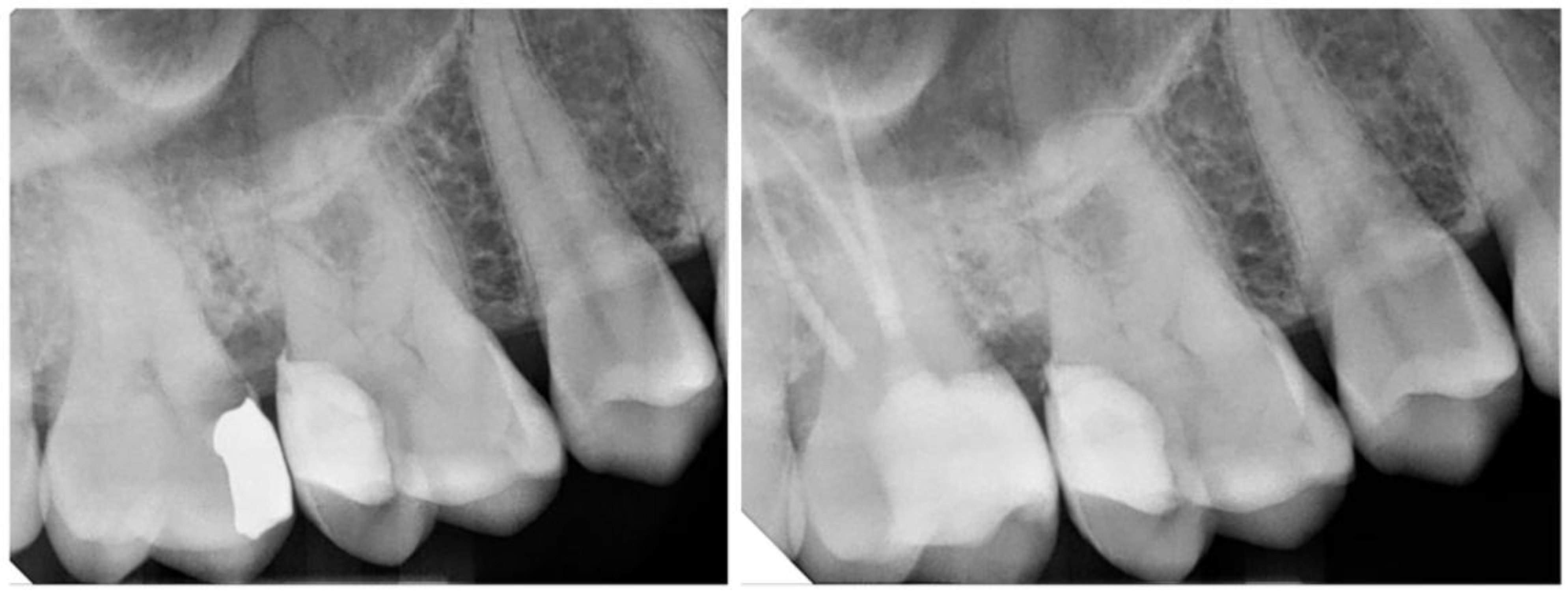 Adhesives 01 00010 g009