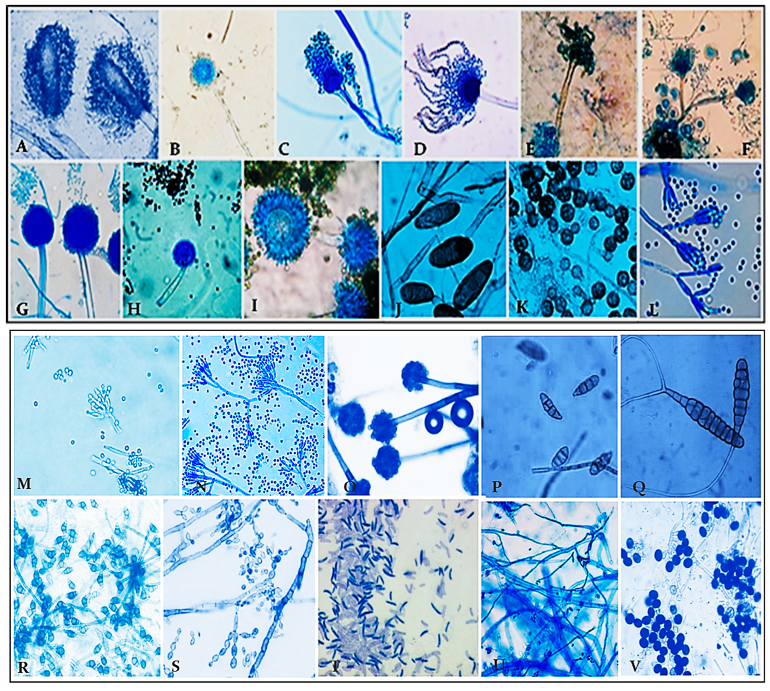 Aerobiology 04 00003 g004