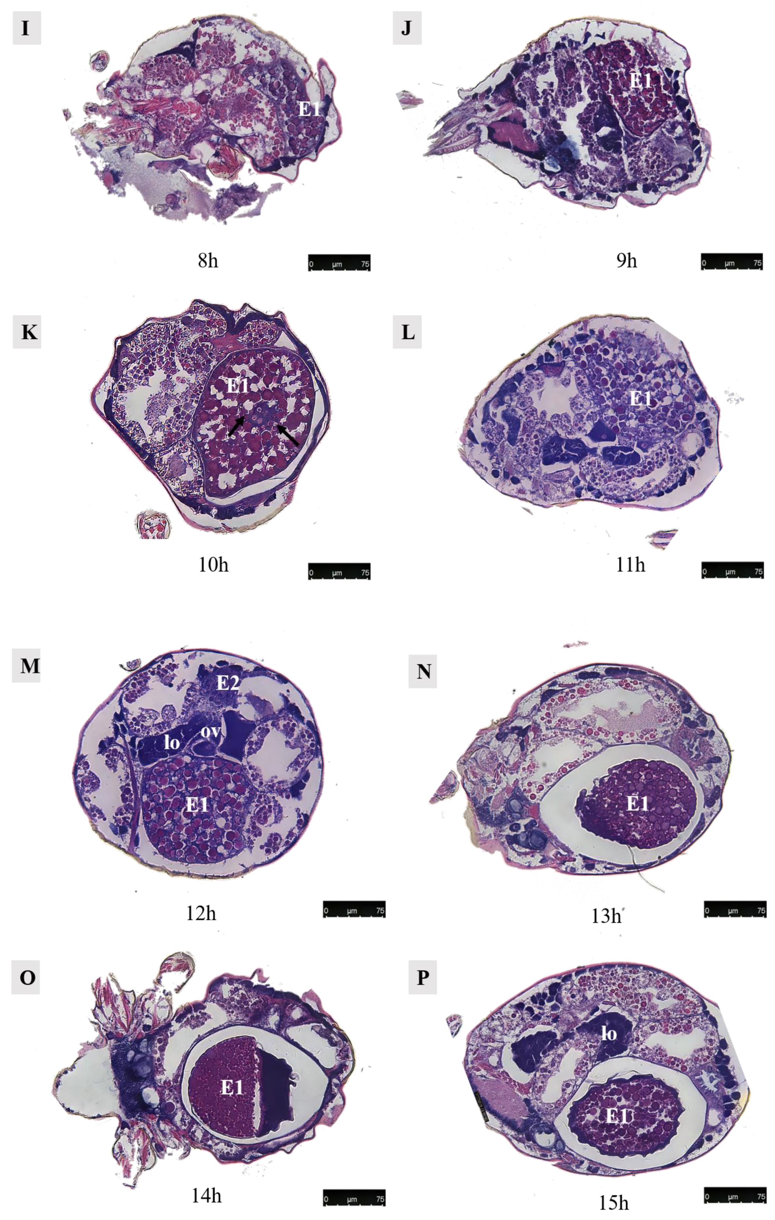 Agriculture 14 01647 g014b