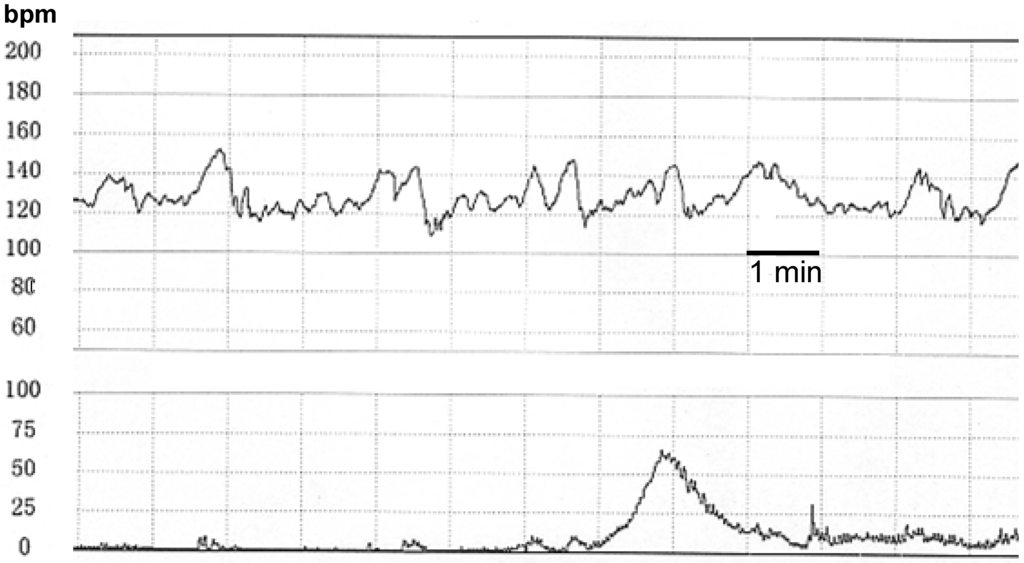 Algorithms 02 00019 g001 1024