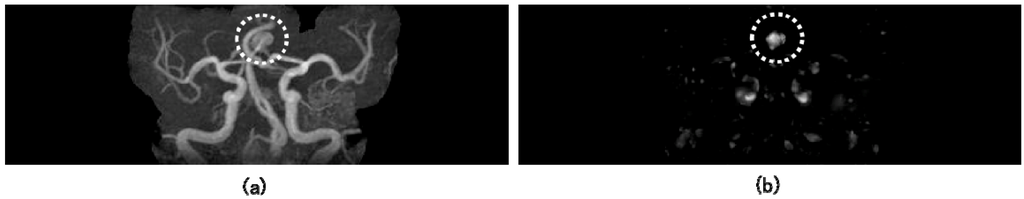 Algorithms 02 00925 g004 1024