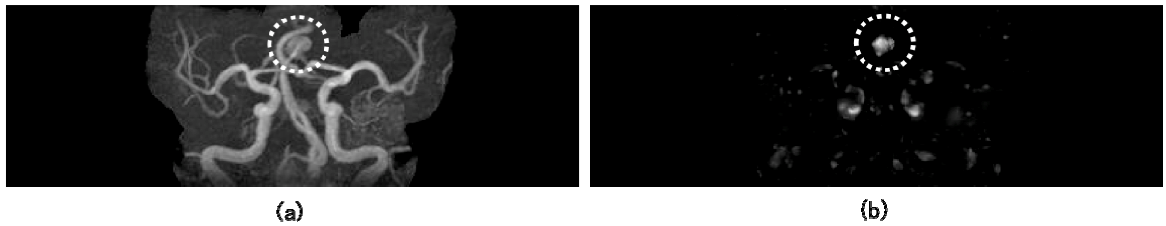 Algorithms 02 00925 g004