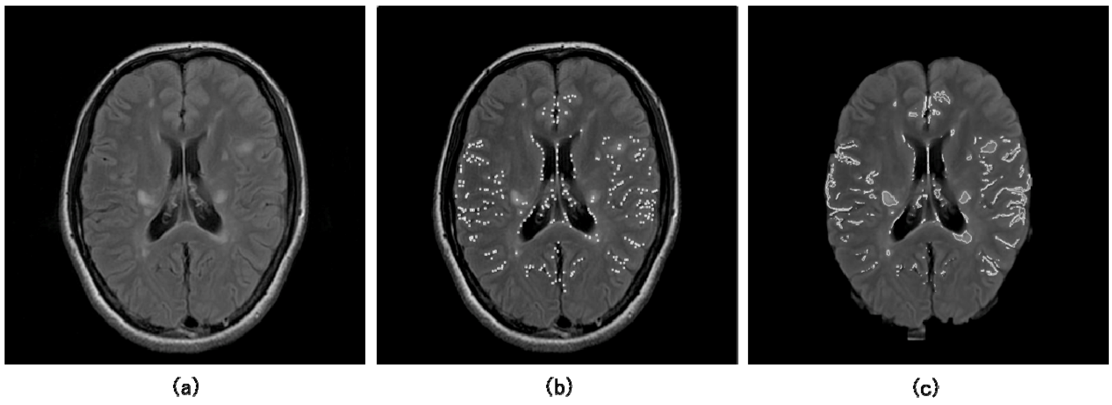 Algorithms 02 00925 g006