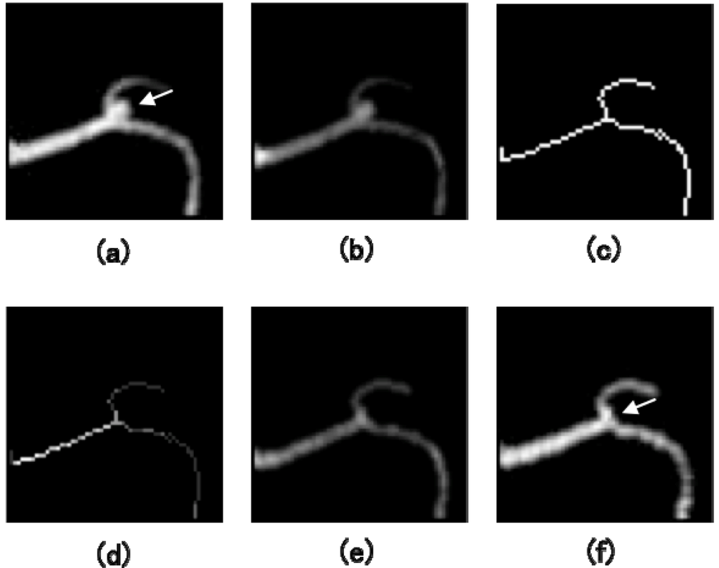 Algorithms 02 00925 g011 1024