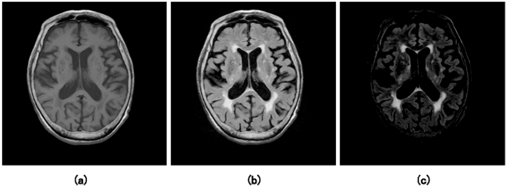 Algorithms 02 00925 g012 1024