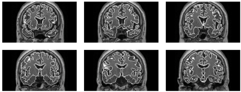 Algorithms 02 00925 g013 1024