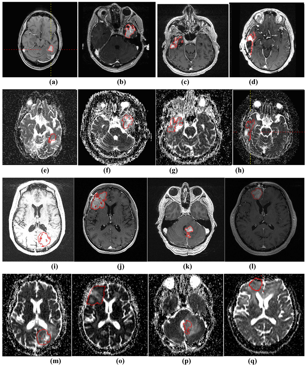 Algorithms 02 01350 g003 1024