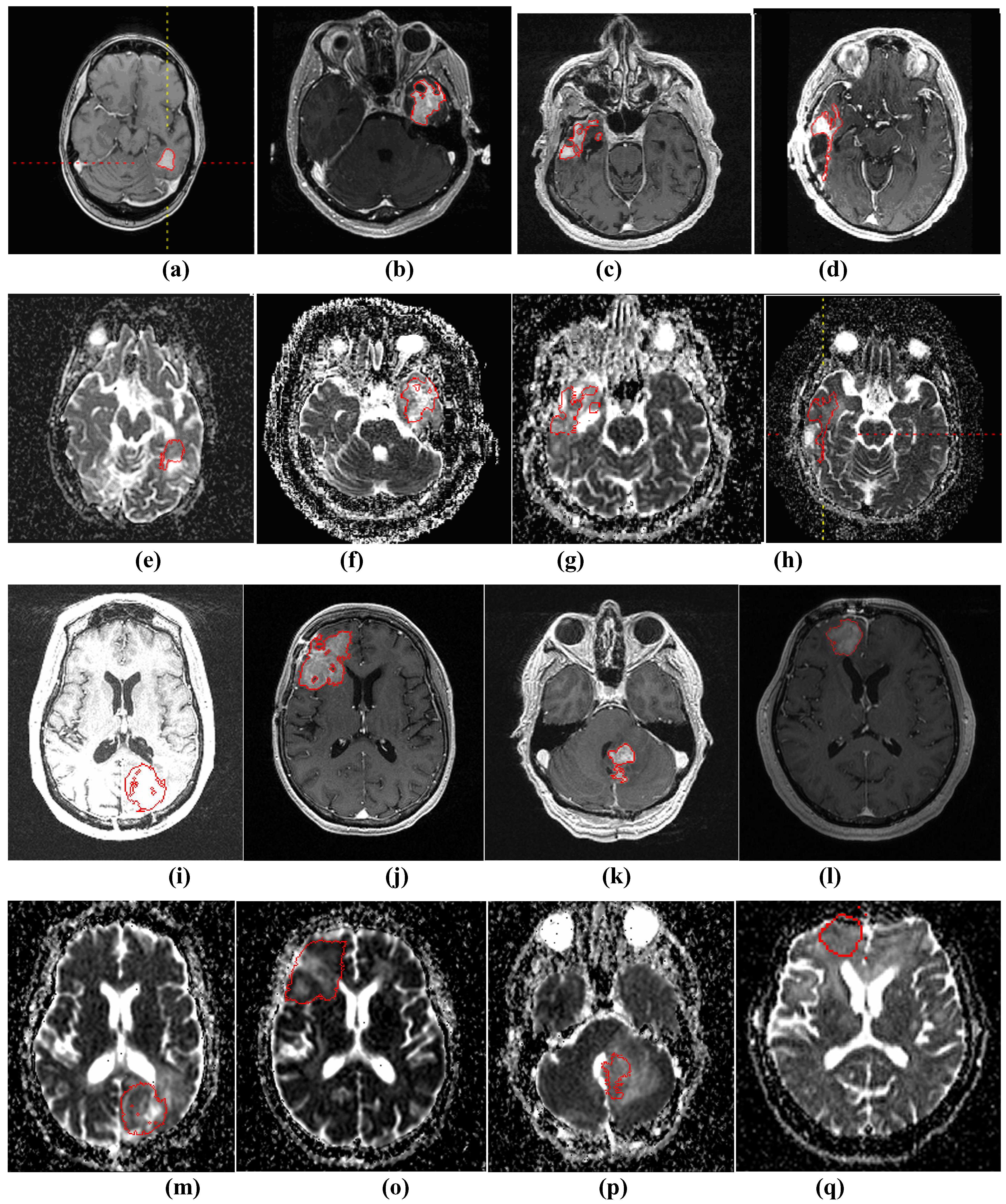 Algorithms 02 01350 g003