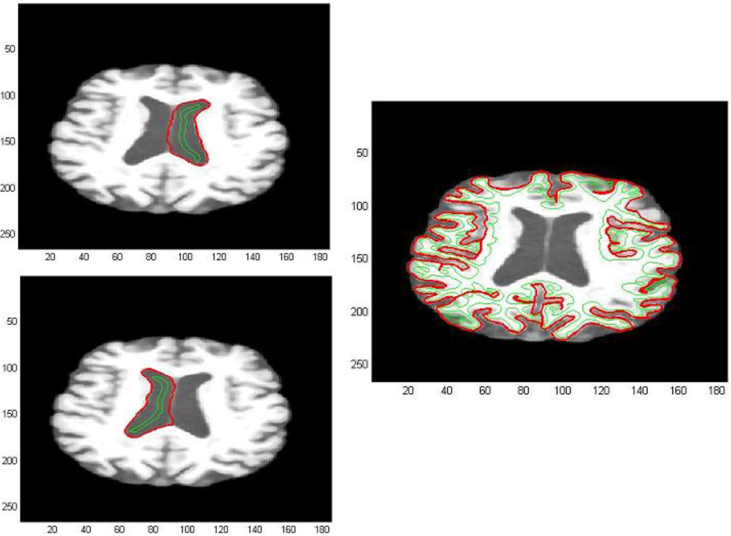 Algorithms 05 00636 g015 1024