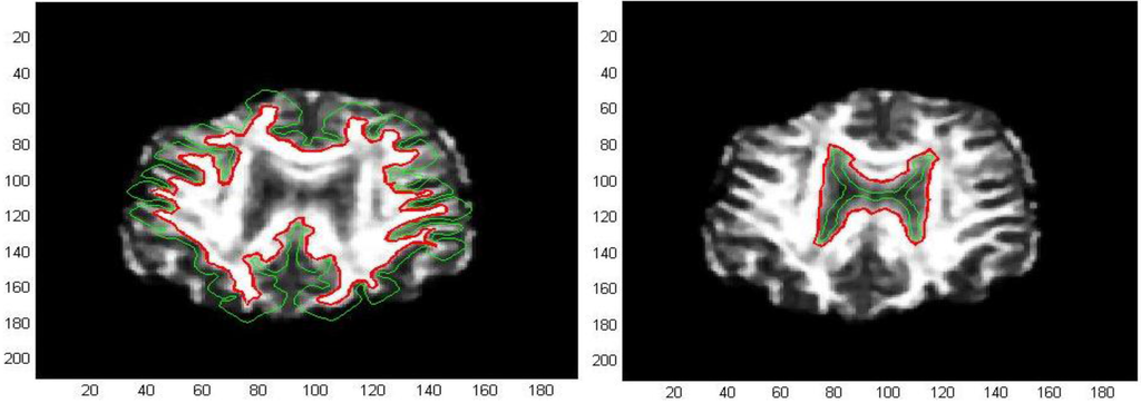 Algorithms 05 00636 g019 1024