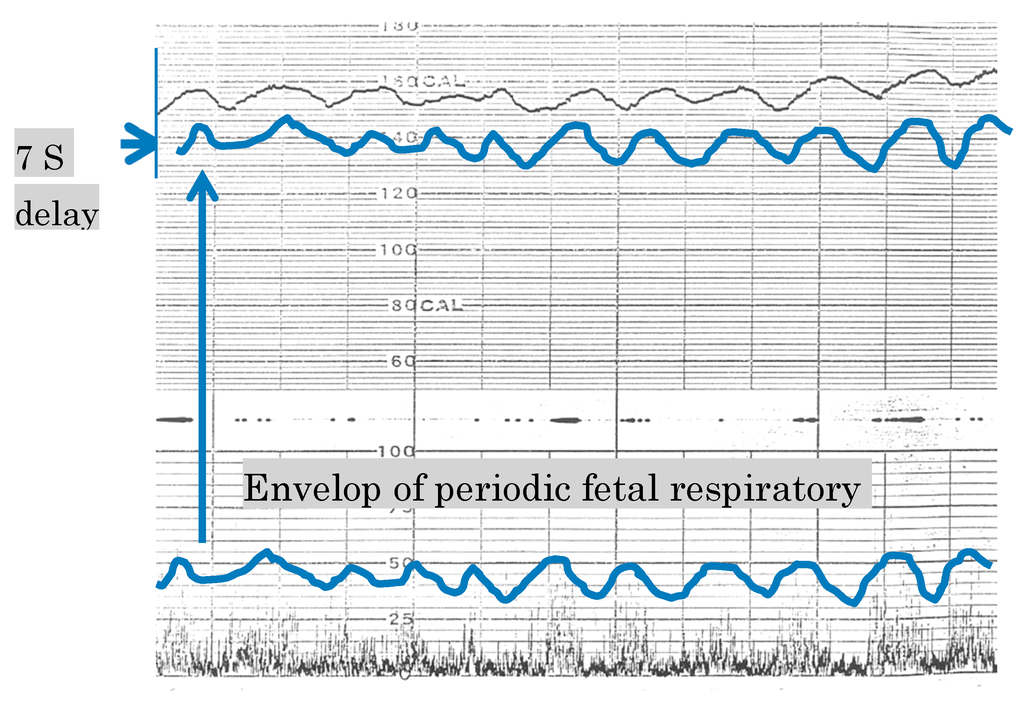 Algorithms 08 00395 g001 1024