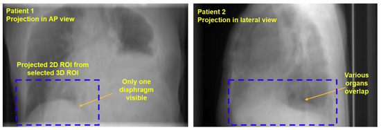 Algorithms 11 00155 g0a2