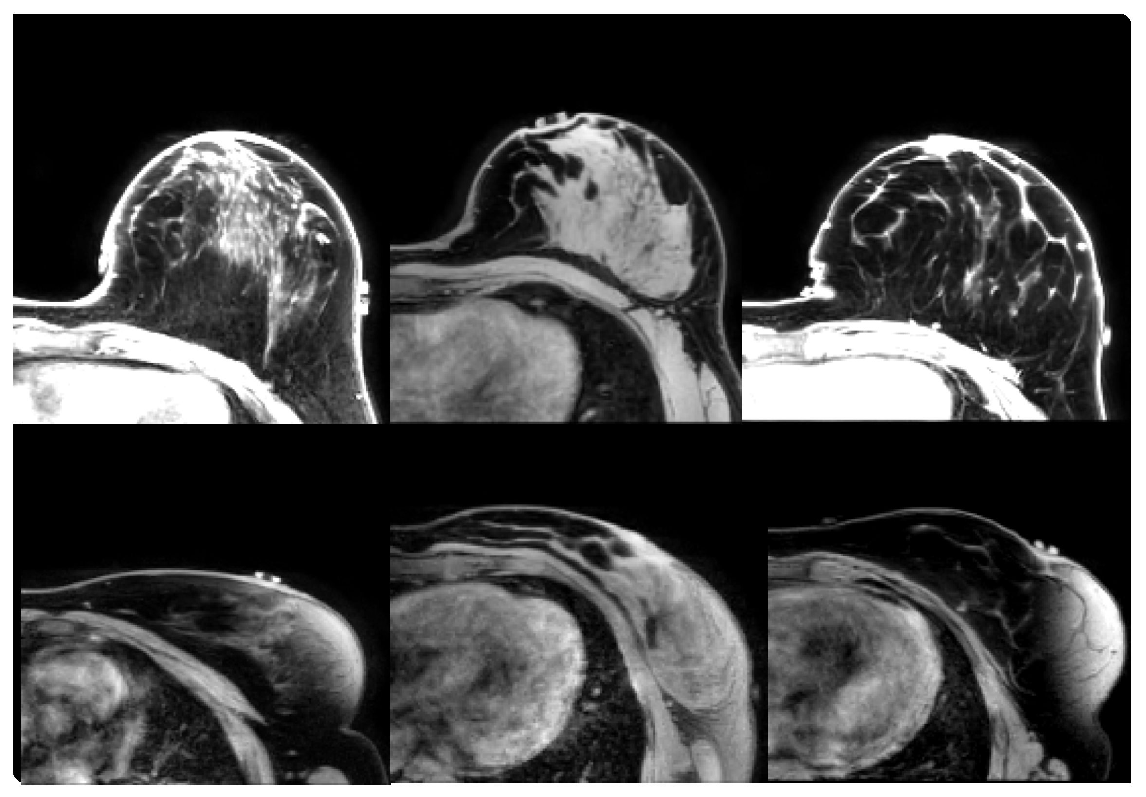 Algorithms 12 00099 g003