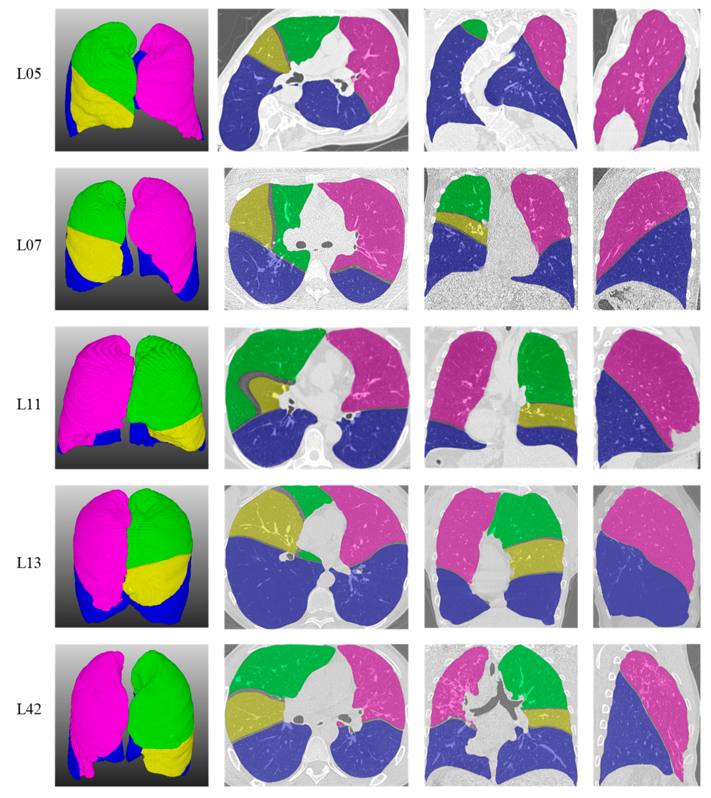 Algorithms 13 00263 g006 Algorithms 13 00263 g006
