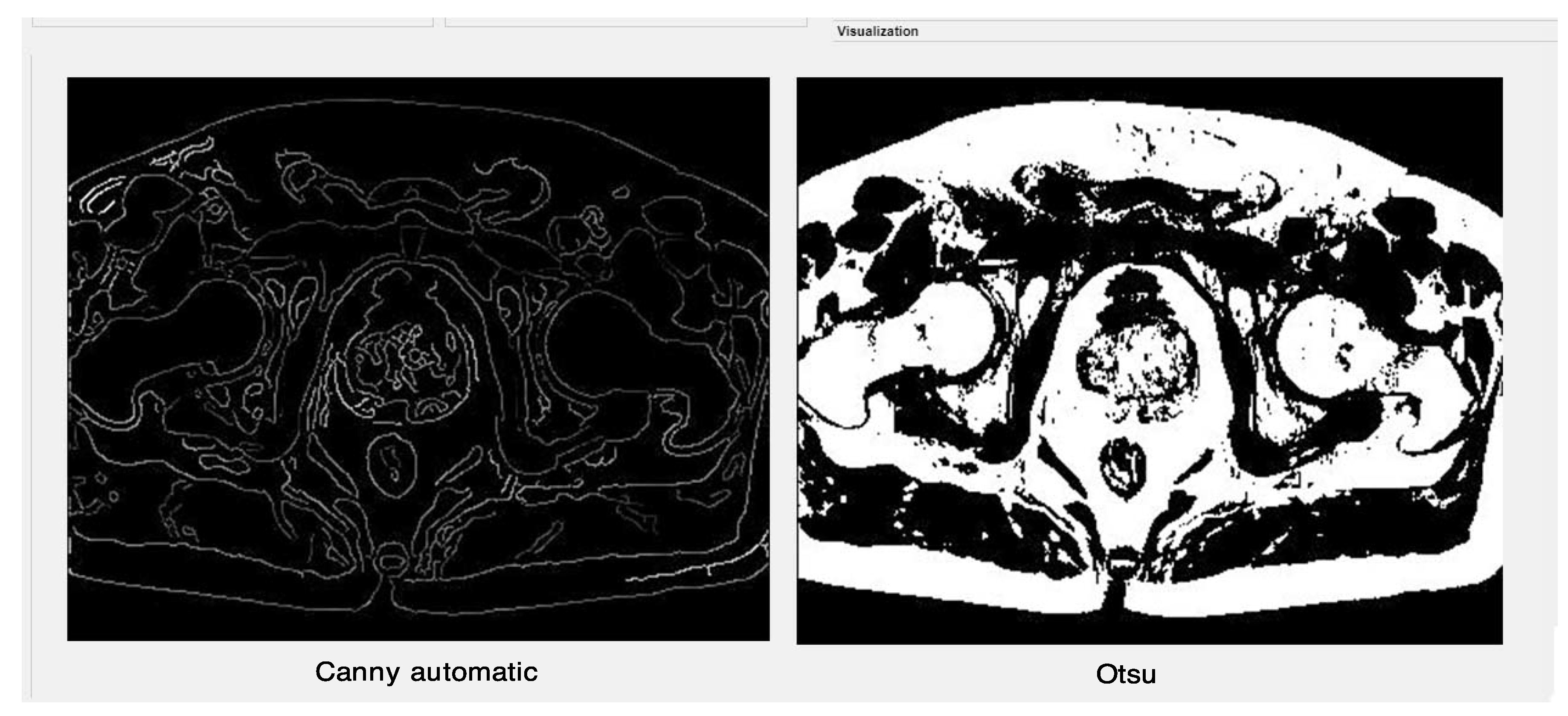 Algorithms 15 00200 g008 Algorithms 15 00200 g008