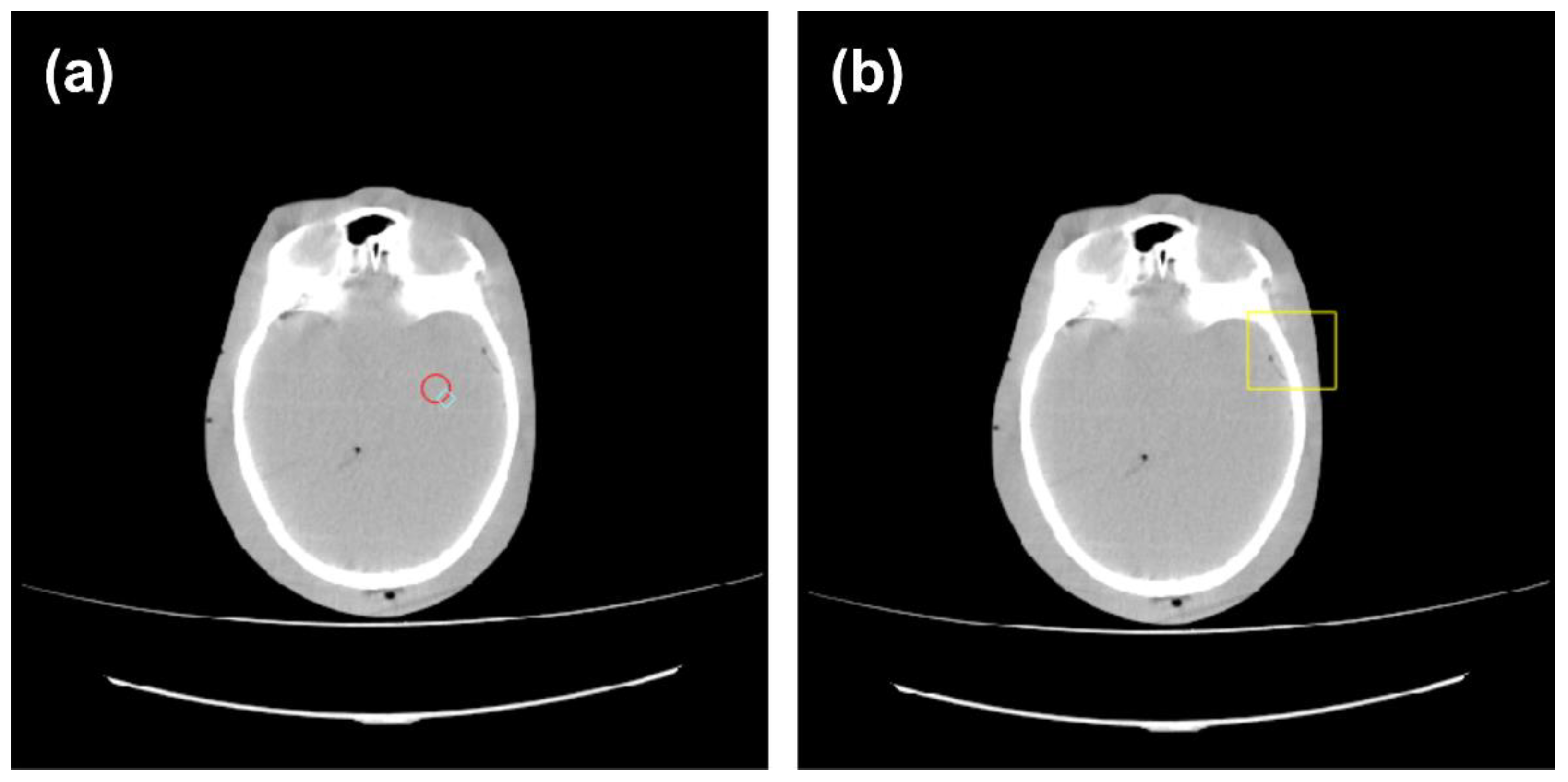 Algorithms 15 00374 g005 Algorithms 15 00374 g005