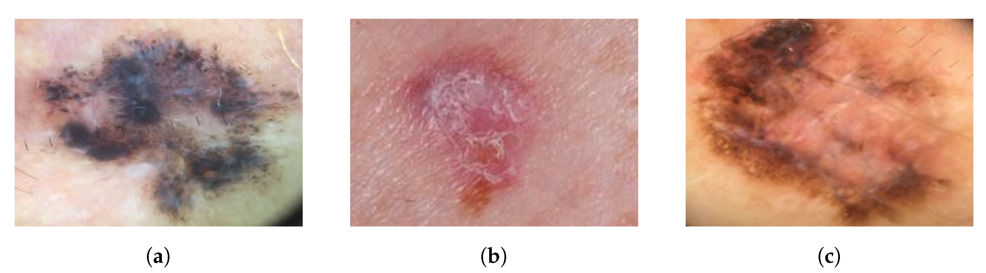 Algorithms 15 00438 g001