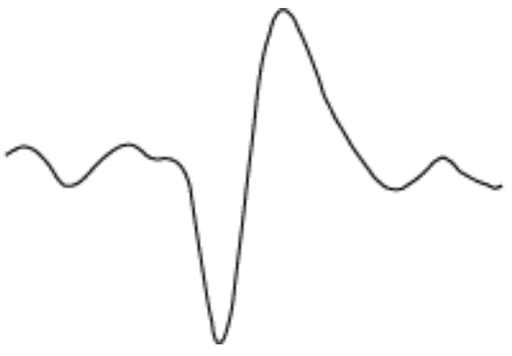 Algorithms 17 00235 i006
