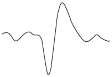 Algorithms 17 00235 i025