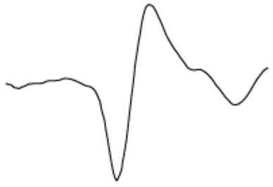 Algorithms 17 00235 i030