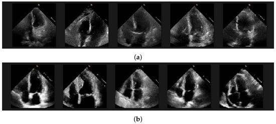Algorithms 17 00515 g0a1