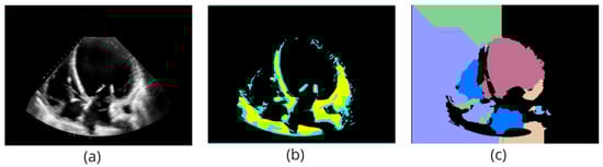 Algorithms 17 00515 g0a9