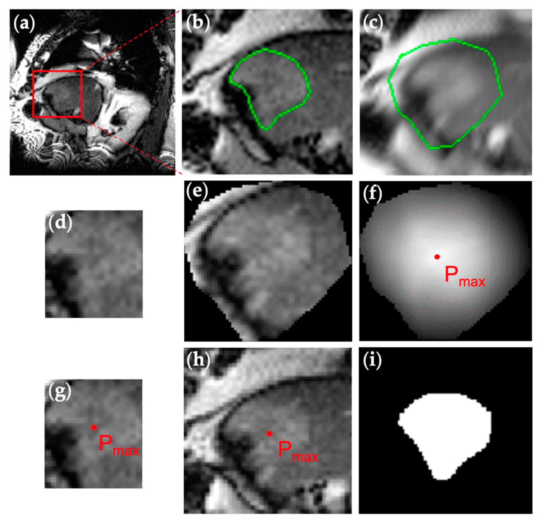Algorithms 18 00233 g003