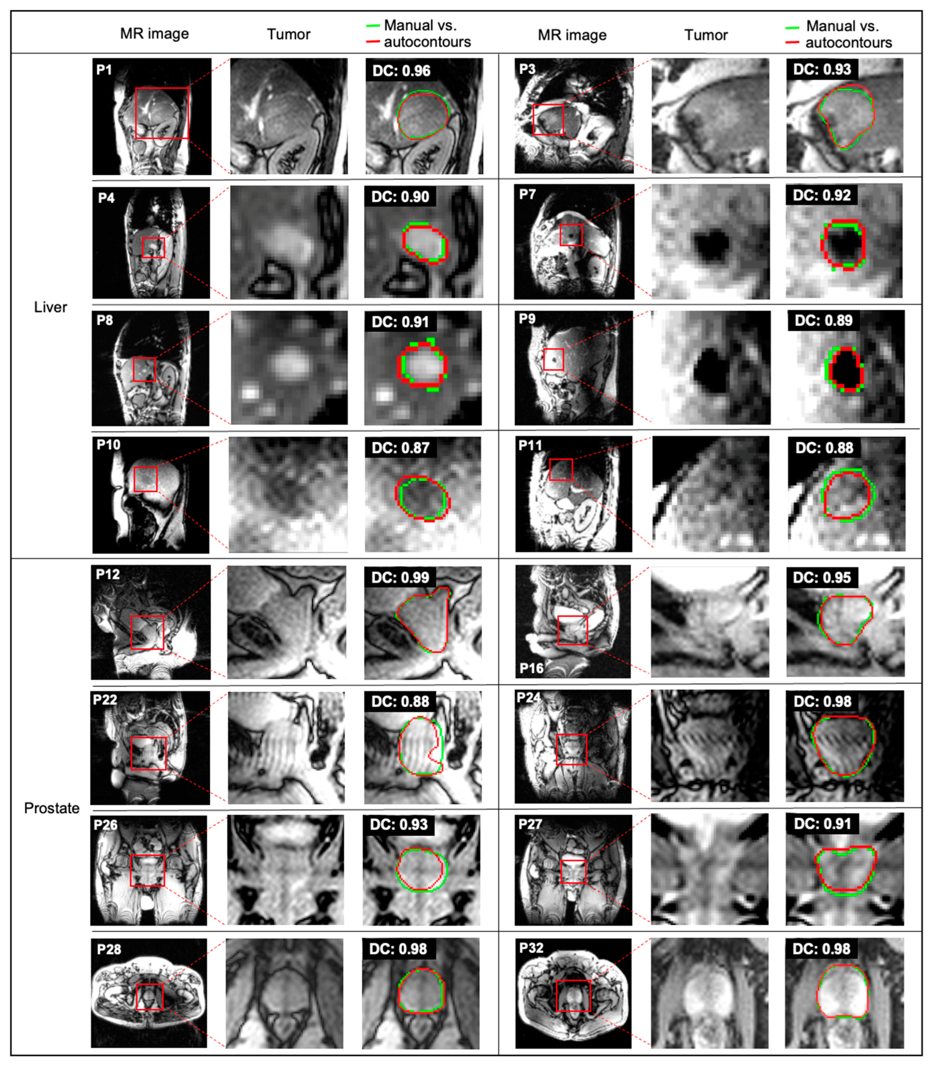 Algorithms 18 00233 g005