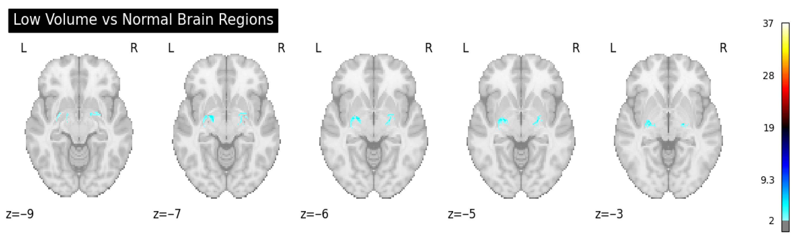Algorithms 18 00509 g005