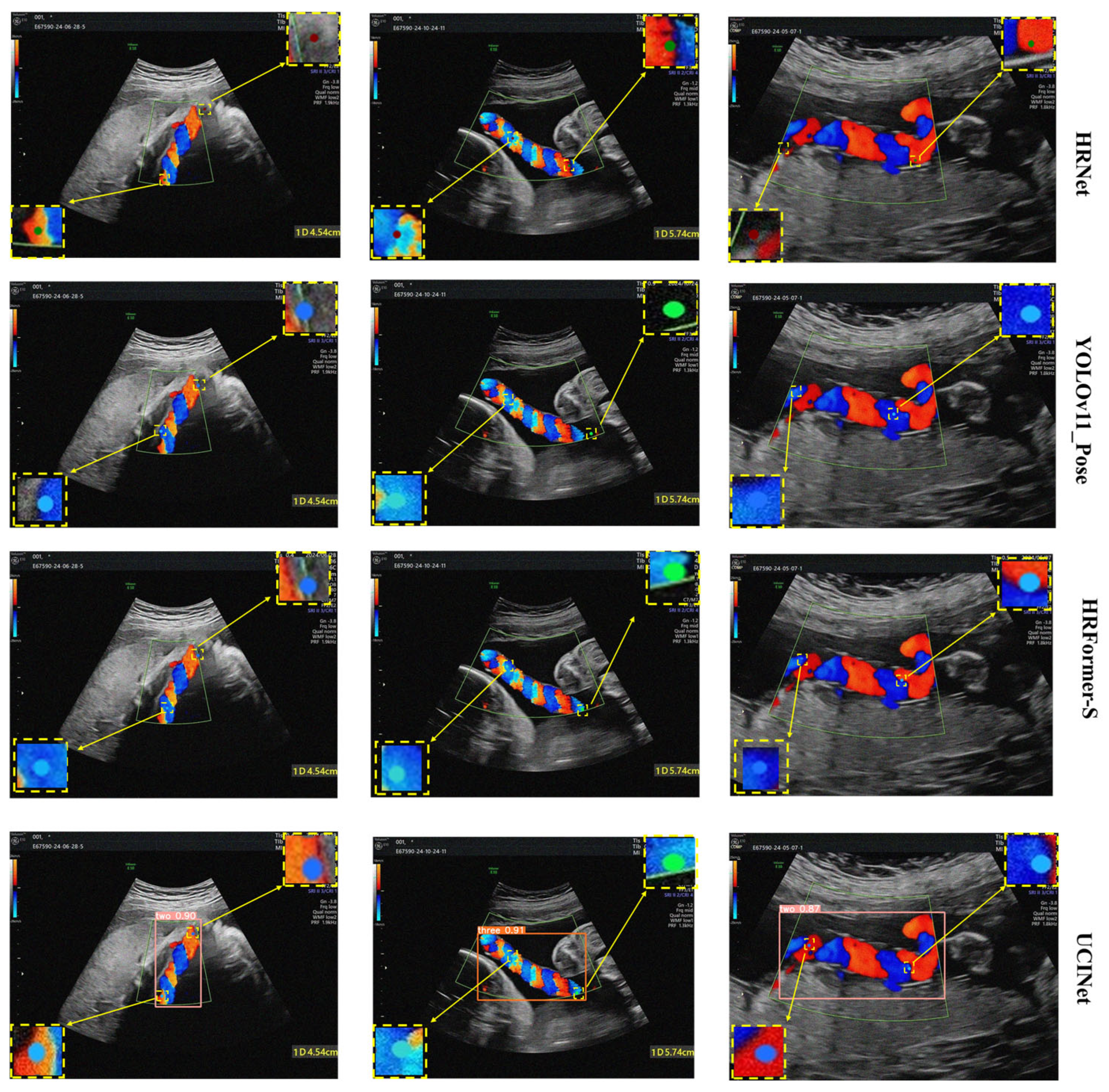 Ucinet Graph UCINet: A Multi-Task Network for Umbilical Coiling Index Measurement in ...