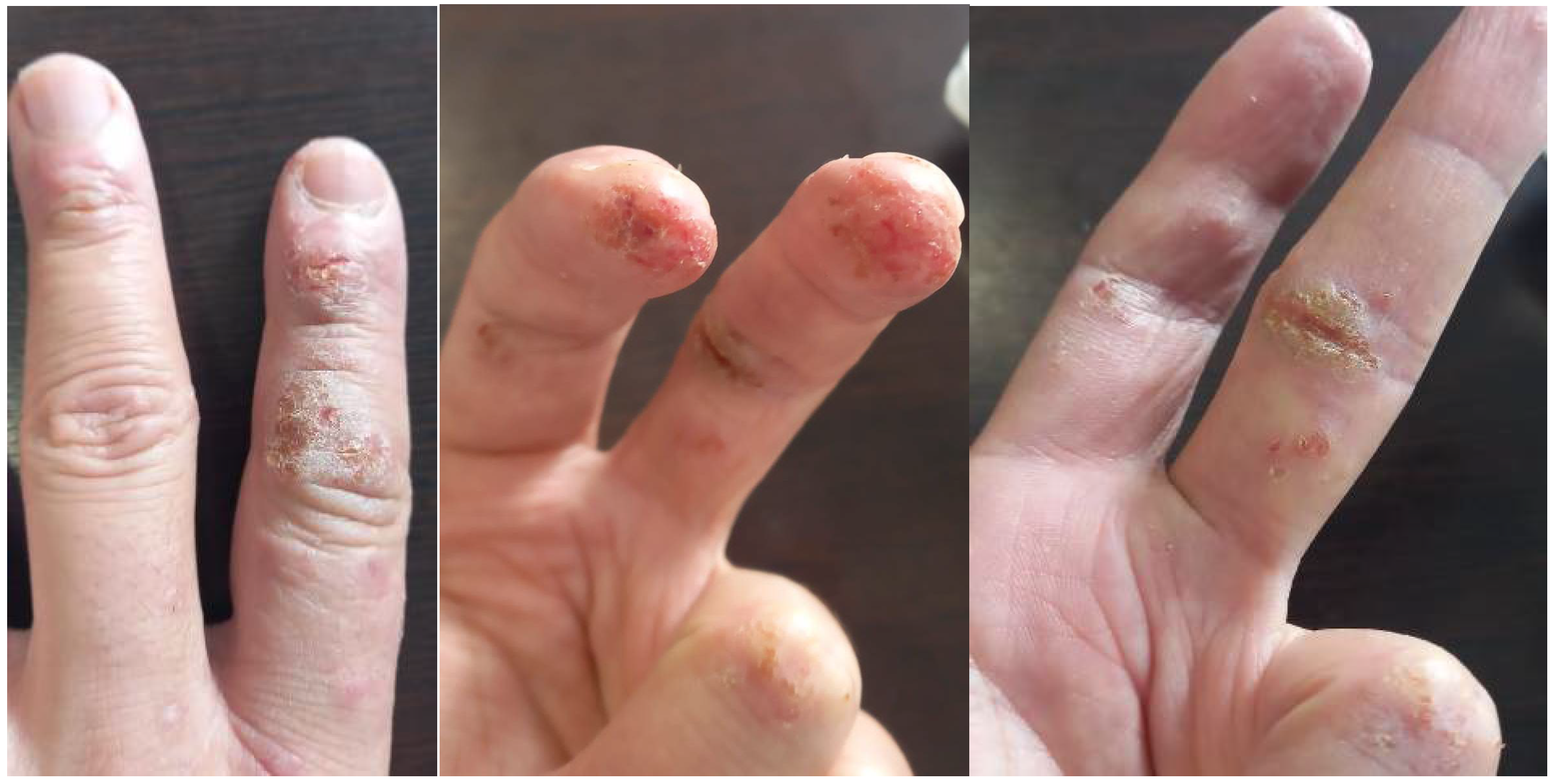 Allergies 02 00007 g001